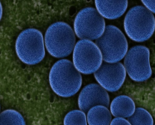 batteri-1